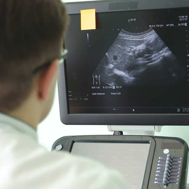 Ambulanta za ultrazvočno diagnostiko